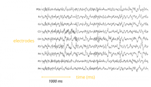 Research on Epilepsy and designing of innovative EEG model