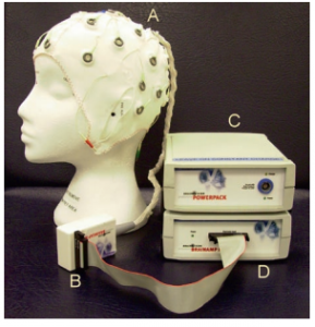 Research on Epilepsy and designing of innovative EEG model